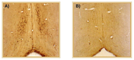 ���߶���192 IgG SAP